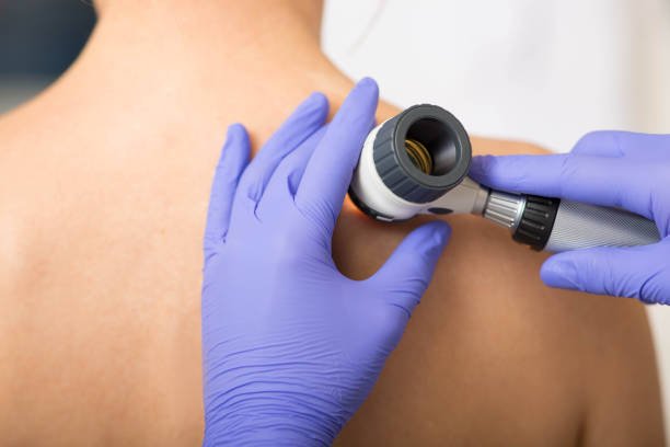 Dermatoscope examination