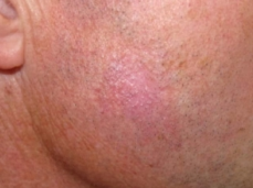 Skin examination close-up