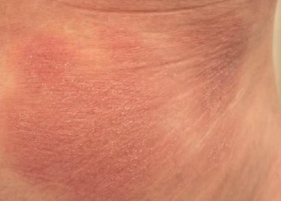 Skin examination close-up