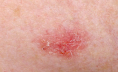 Skin examination close-up