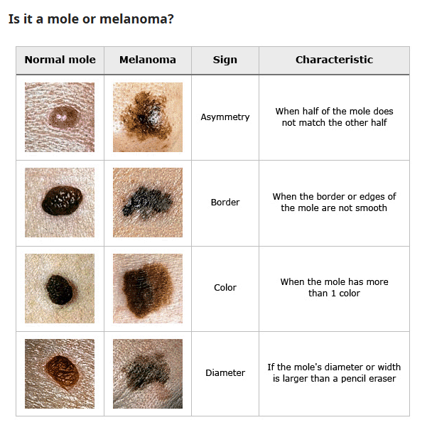 Skin examination close-up