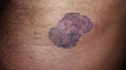 Skin examination close-up