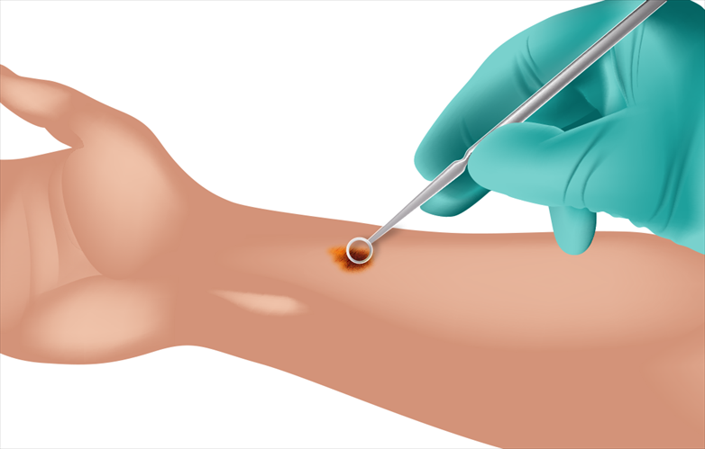 Skin examination close-up